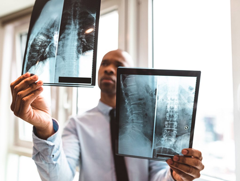 Male-doctor-reviewing-spinal-x-ray-scans-at-a-personal-injury-clinic-in-San-Antonio